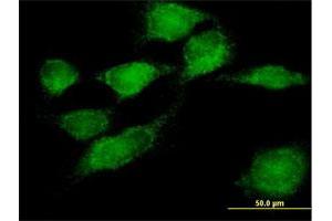 Immunofluorescence of purified MaxPab antibody to SNX11 on HeLa cell. (SNX11 抗体  (AA 1-270))