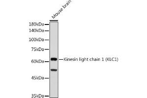Western blot analysis of extracts of Mouse brain, using Kinesin light chain 1 (Kinesin light chain 1 (KLC1)) antibody (ABIN7268139) at 1:1000 dilution. (KLC1 抗体)