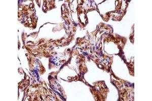 Immunohistochemistry (IHC) image for anti-Wingless-Type MMTV Integration Site Family, Member 3A (WNT3A) (AA 151-180) antibody (ABIN3029629)