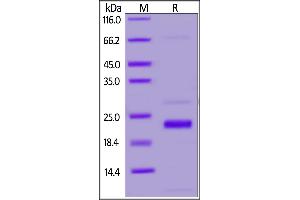 SARS-CoV-2 NSP1, His Tag on SDS-PAGE under reducing (R) condition. (SARS-CoV-2 NSP1 Protein (His tag))