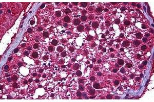 Human Testis: Formalin-Fixed, Paraffin-Embedded (FFPE) (SP140 抗体  (AA 504-613))