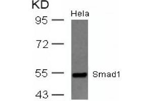Image no. 2 for anti-SMAD, Mothers Against DPP Homolog 1 (SMAD1) (AA 461-465) antibody (ABIN319351) (SMAD1 抗体  (AA 461-465))