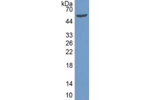 Rabbit Capture antibody from the kit in WB with Positive Control: Sample Human Skin lysate.