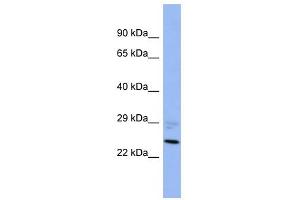 PPM1B antibody used at 1 ug/ml to detect target protein. (PPM1B 抗体)
