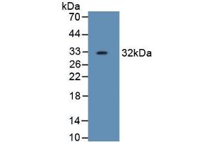 Detection of Recombinant HPR, Human using Monoclonal Antibody to Haptoglobin Related Protein (HPR) (HPR 抗体  (AA 102-347))