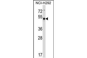 Western blot analysis in NCI-H292 cell line lysates (35ug/lane). (ACTR6 抗体  (C-Term))