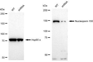 Western blotting analysis using Nucleoporin 155 antibody (ABIN7799675). (Recombinant NUP155 抗体)