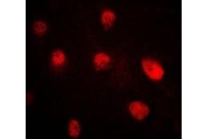 Immunofluorescent analysis of Pr-Set7 staining in MCF7 cells. (SETD8 抗体)
