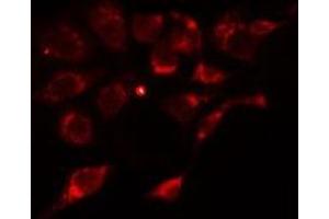 ABIN6275913 staining Hela cells by IF/ICC. (Adenosine A2a Receptor 抗体  (Internal Region))