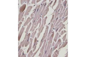 (ABIN6243895 and ABIN6578867) staining MYL1 in human heart tissue sections by Immunohistochemistry (IHC-P - paraformaldehyde-fixed, paraffin-embedded sections). (MYL1 抗体  (AA 24-58))