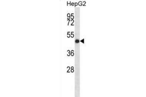 Western Blotting (WB) image for anti-Indian Hedgehog (IHH) antibody (ABIN2998360) (Indian Hedgehog 抗体)