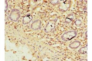 Immunohistochemistry of paraffin-embedded human small intestine tissue using ABIN7176140 at dilution of 1:100 (ZNF19 抗体  (AA 1-200))