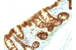 Immunohistochemistry (IHC) image for anti-Epithelial Cell Adhesion Molecule (EPCAM) antibody (ABIN6933748)