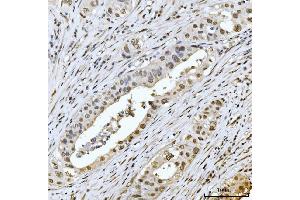 IHC analysis of MRE11 using anti-MRE11 antibody (ABIN7600025).