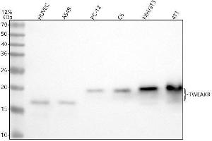 Western blot analysis of TWEAKR using anti-TWEAKR antibody (ABIN7606612).