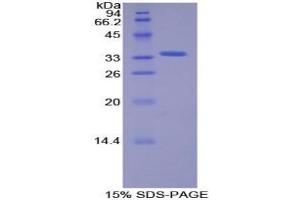 SDS-PAGE analysis of Human SIK2 Protein.