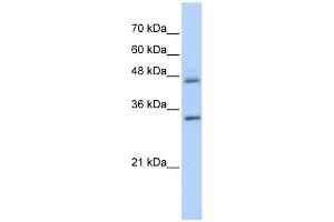 PRELP antibody used at 1 ug/ml to detect target protein. (PRELP 抗体  (Middle Region))