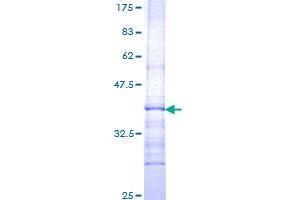 Image no. 1 for Glucosidase, Beta, Acid (GBA) (AA 146-235) protein (GST tag) (ABIN1354863)