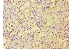 Immunohistochemistry of paraffin-embedded human pancreatic tissue using ABIN7151000 at dilution of 1:100 (CBLC 抗体  (AA 245-474))