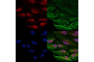 ABIN6263148 and ABIN6278191 staining  cells by IF/ICC.