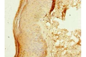 Immunohistochemistry of paraffin-embedded human skin tissue using ABIN7176485 at dilution of 1:100 (ZNF688 抗体  (AA 1-276))