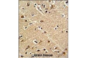 Immunohistochemistry (Paraffin-embedded Sections) (IHC (p)) image for anti-ZW10 Interactor (ZWINT) (AA 59-88) antibody (ABIN390639)
