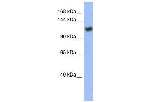 WB Suggested Anti-ZNF423 Antibody Titration:  0. (Znf423 抗体  (Middle Region))