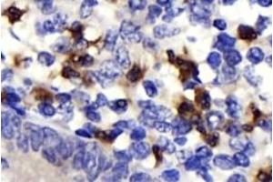 Immunohistochemistry analysis of paraffin-embedded human epityphlon using,NK-p44 (ABIN7074778) at dilution of 1: 500 (NKp44/NCR2 抗体)