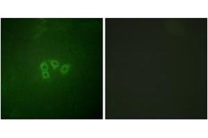 Immunofluorescence analysis of A549 cells, using eIF4B (Ab-422) Antibody. (EIF4B 抗体  (AA 388-437))