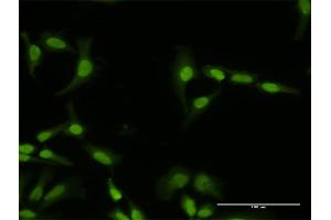 Immunofluorescence of purified MaxPab antibody to PI4K2A on HeLa cell. (PI4K2A 抗体  (AA 1-479))