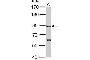 Western Blotting (WB) image for anti-Inhibitor of kappa Light Polypeptide Gene Enhancer in B-Cells, Kinase beta (IKBKB) (C-Term) antibody (ABIN2856162)