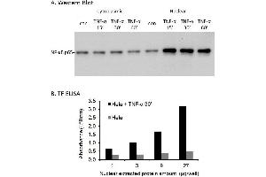 Transcription factor activity assay of NF-κB p65 from nuclear extracts of HeLa cells or HeLa cells treated with TNF-a. (NF-kB p65 ELISA 试剂盒)