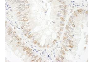 Immunohistochemistry (IHC) image for anti-BRCA2 and CDKN1A Interacting Protein (BCCIP) (AA 300-350) antibody (ABIN7448933) (BCCIP 抗体  (AA 300-350))