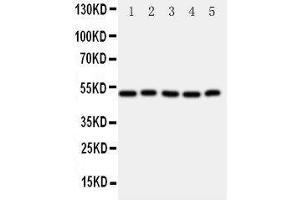 Western Blotting (WB) image for anti-Aldehyde Dehydrogenase 3 Family, Member A1 (ALDH3A1) (AA 440-453), (C-Term) antibody (ABIN3042917) (ALDH3A1 抗体  (C-Term))