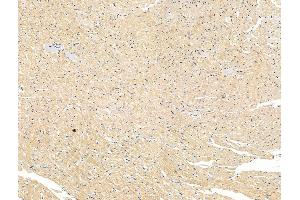 ABIN7094628 and ABIN7098678 at 1/100 staining Rat heart tissue by IHC-P. (LOXL2 抗体  (Internal Region))