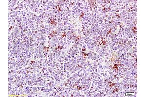 Formalin-fixed and paraffin embedded rat thymus tissue labeled Anti-PCNA Polyclonal Antibody, Unconjugated (ABIN672756) at 1:200, followed by conjugation to the secondary antibody and DAB staining