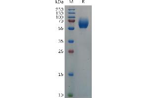 SDS-PAGE (SDS) image for Interleukin 18 Binding Protein (IL18BP) (AA 28-207) protein (Fc Tag) (ABIN7490671)