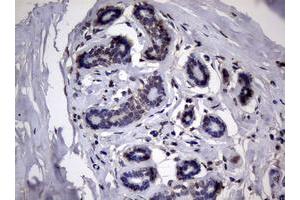 Image no. 2 for anti-Ribonucleotide Reductase M1 (RRM1) (AA 541-792) antibody (ABIN1491583) (RRM1 抗体  (AA 541-792))