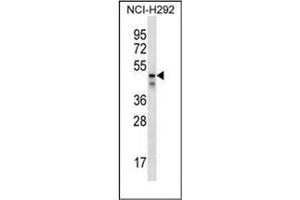 Western blot analysis of PDZK1 Antibody (Center) in NCI-H292 cell line lysates (35ug/lane). (PDZK1 抗体  (Middle Region))