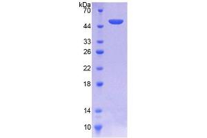 SDS-PAGE analysis of Human SPINT2 Protein. (SPINT2 蛋白)