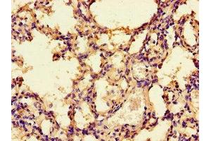 Immunohistochemistry of paraffin-embedded human lung tissue using ABIN7142675 at dilution of 1:100