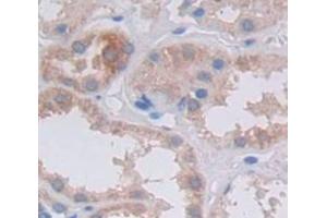 Used in DAB staining on fromalin fixed paraffin- embedded Kidney tissue (FRK 抗体  (AA 234-491))