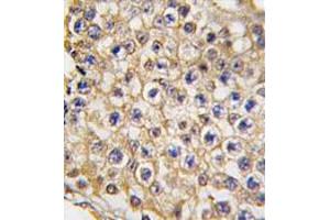 Image no. 1 for anti-Transient Receptor Potential Cation Channel, Subfamily V, Member 3 (TRPV3) (N-Term) antibody (ABIN356905)