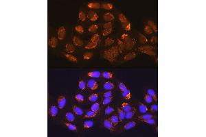 Immunofluorescence analysis of U-2 OS cells using MUT Rabbit pAb (ABIN1680932, ABIN3018357, ABIN3018358 and ABIN6220443) at dilution of 1:100 (40x lens). (MUT 抗体  (AA 451-750))