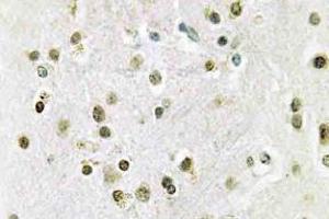 Immunohistochemistry (IHC) analyzes of DGK-theta antibody in paraffin-embedded human brain tissue. (DGKQ 抗体)