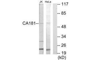 Western blot analysis of extracts from Jurkat cells and HeLa cells, using CA181 antibody. (ZNHIT6 抗体)