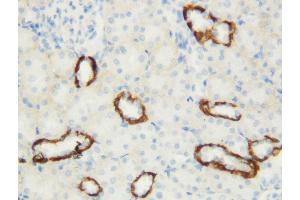 Immunohistochemistry (IHC) image for anti-Aquaporin 3 (Gill Blood Group) (AQP3) (AA 278-292), (C-Term) antibody (ABIN3044413)