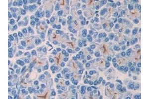 Detection of CD55 in Rat Pancreas Tissue using Polyclonal Antibody to Cluster Of Differentiation 55 (CD55) (CD55 抗体  (AA 254-372))