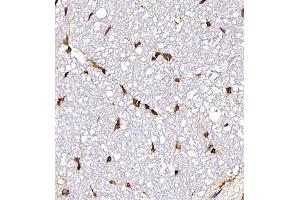 Immunohistochemistry (Paraffin-embedded Sections) (IHC (p)) image for anti-Neurotensin (NTS) antibody (ABIN7074827)