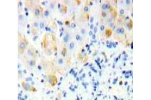 Used in DAB staining on fromalin fixed paraffin-embedded Liver tissue (SIGLEC12 抗体  (AA 27-141))
